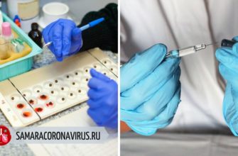 Отрицательный резус и коронавирус — связь